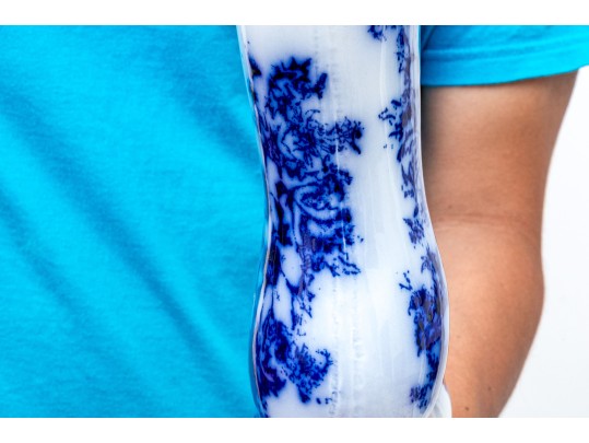 Elegant Blue And White Porcelain