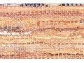 Leather And Fabric Chindi Dhurrie Accent Carpet, 6'-1